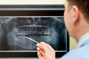 person looking at an x-ray